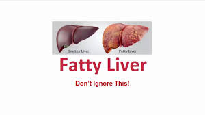 silent liver disease